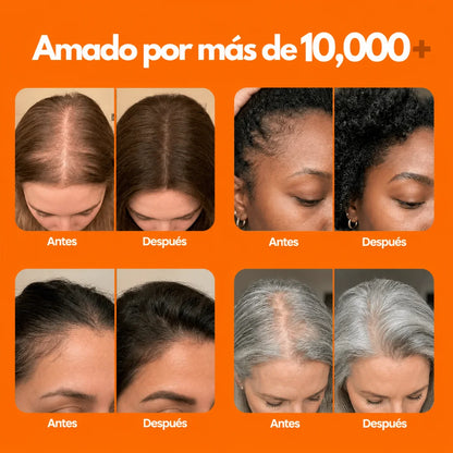 Sérum Coreano N°1 para el Crecimiento del Cabello