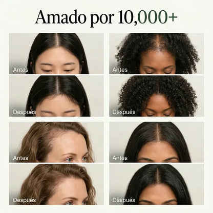 Shampoo de revitalización capilar coreana